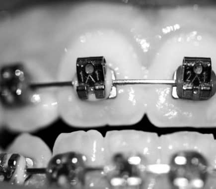 dentalxperts dental xperts dentistas ortodoncia